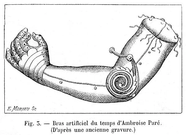 Artificial arm by Ambroise Par