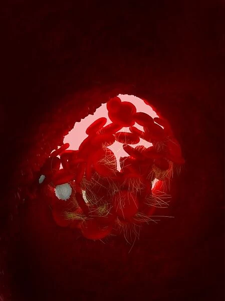 Blood clot, artwork C016  /  4619