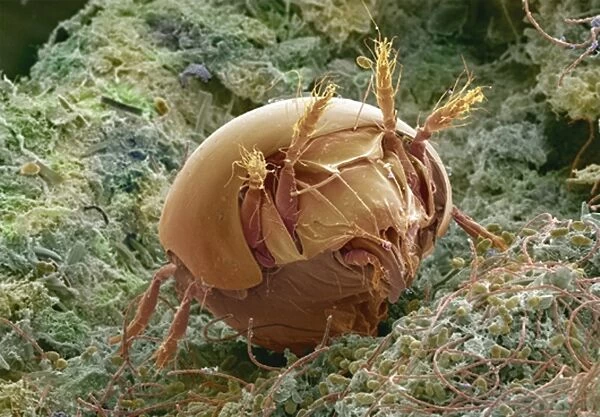 Soil mite. Coloured scanning electron micrograph 