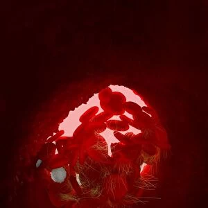 Blood clot, artwork C016 / 4619