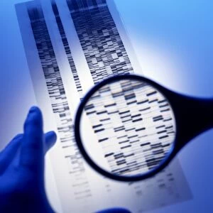 DNA autoradiogram